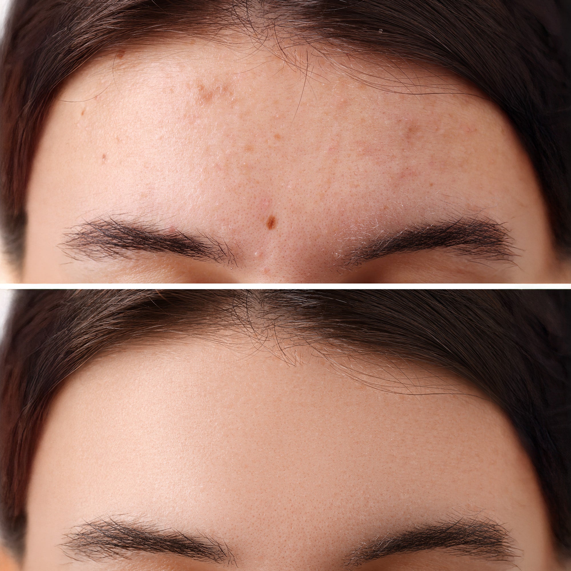 Acido Glicólico 130ml