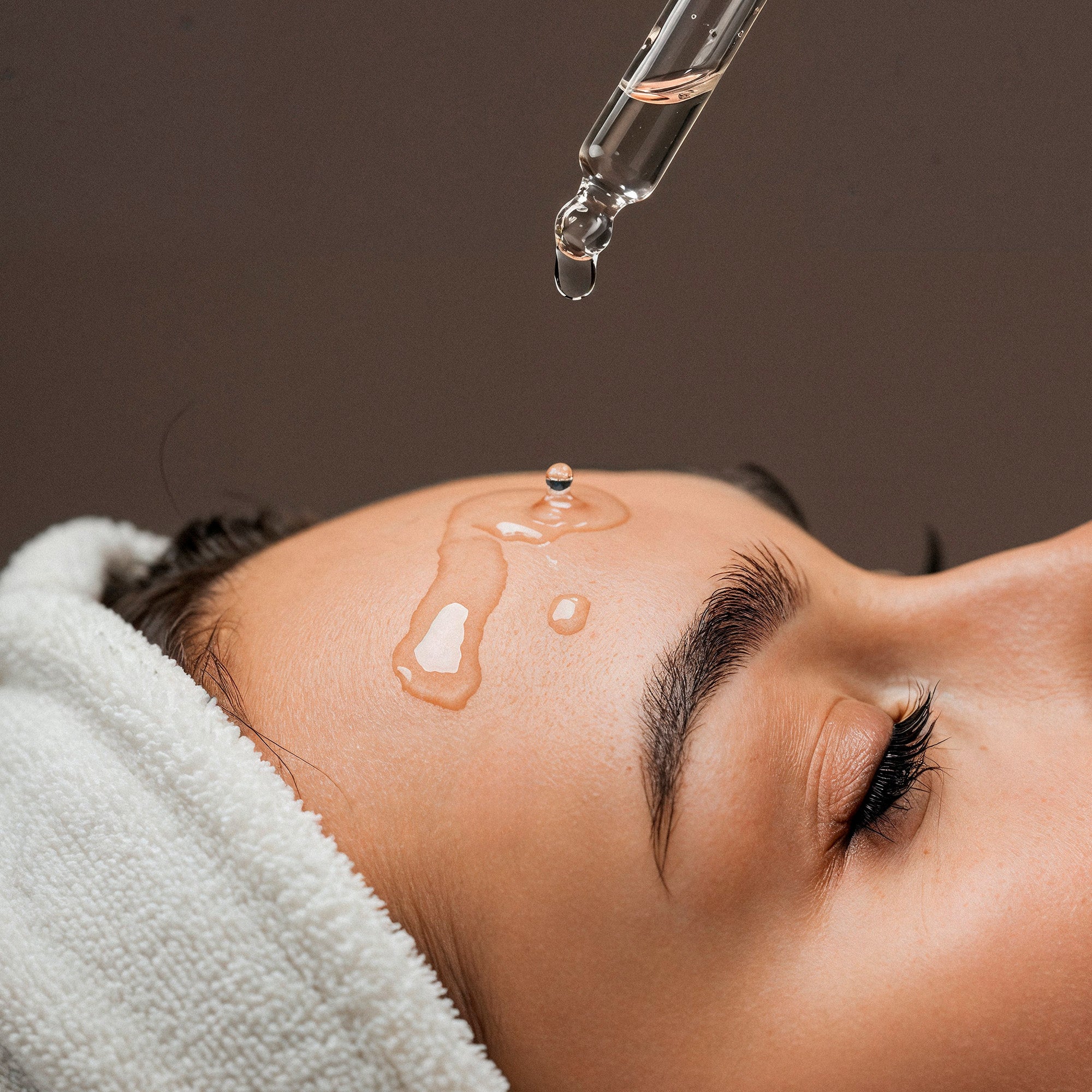 Serum Niacinamide control de Acne